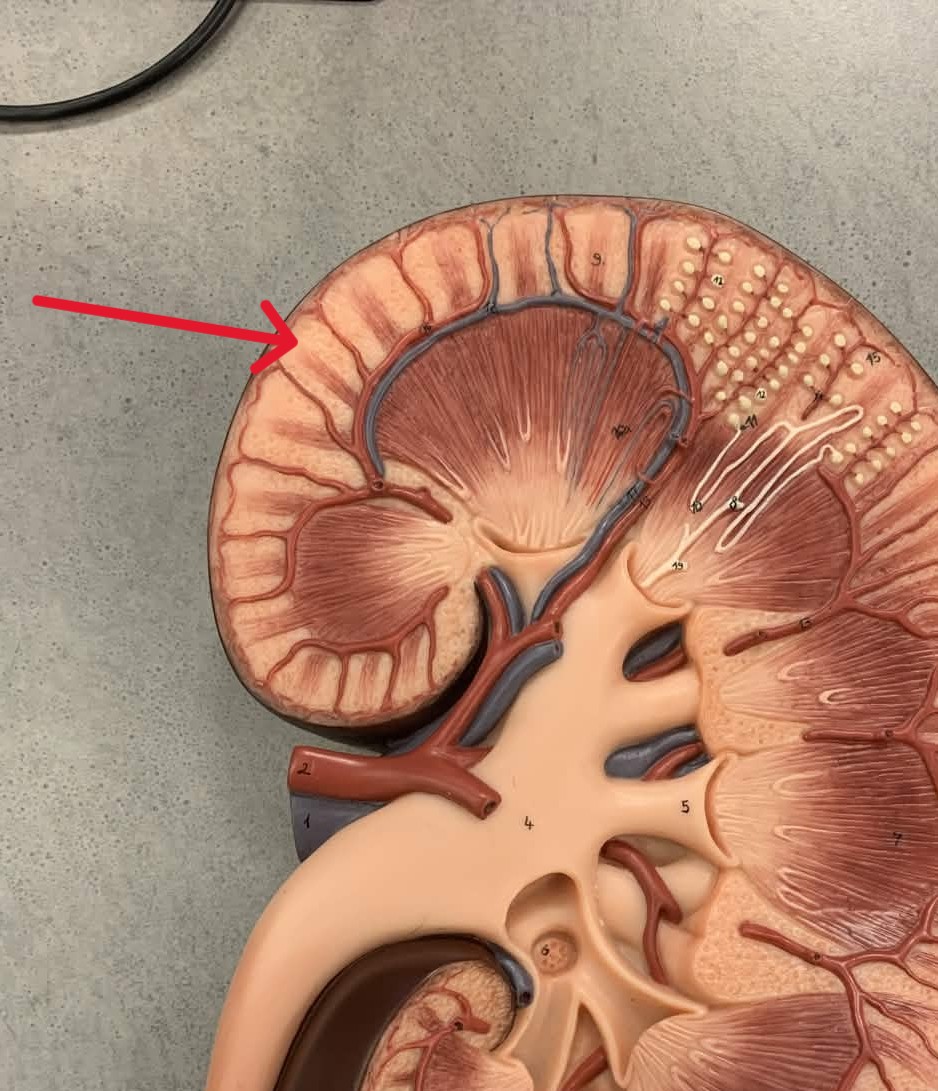 <p>Which part of the kidneys:</p><ul><li><p>The outer portion of the kidneys</p></li></ul><p></p>