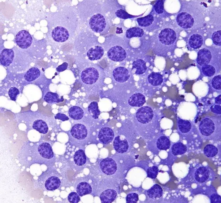 <p>1) terminologie papanicolaou</p><p>2) diagnostic</p><p>3) critères </p><p>4) grading </p>