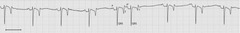 <p>Describe this ECG</p>