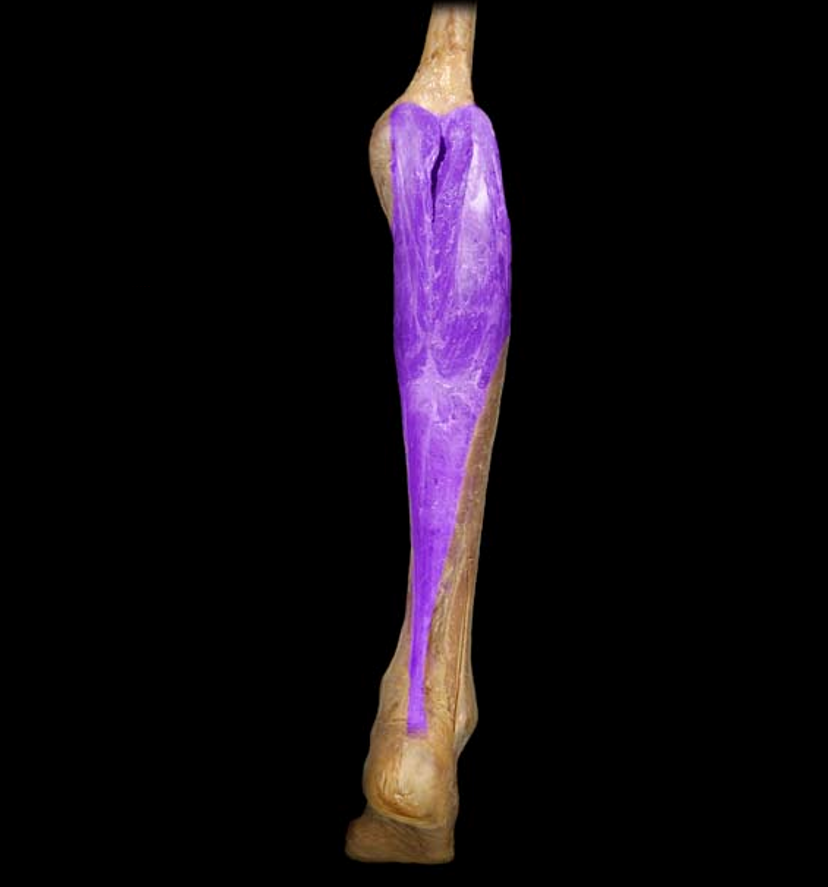 <p>What muscle is this?</p>