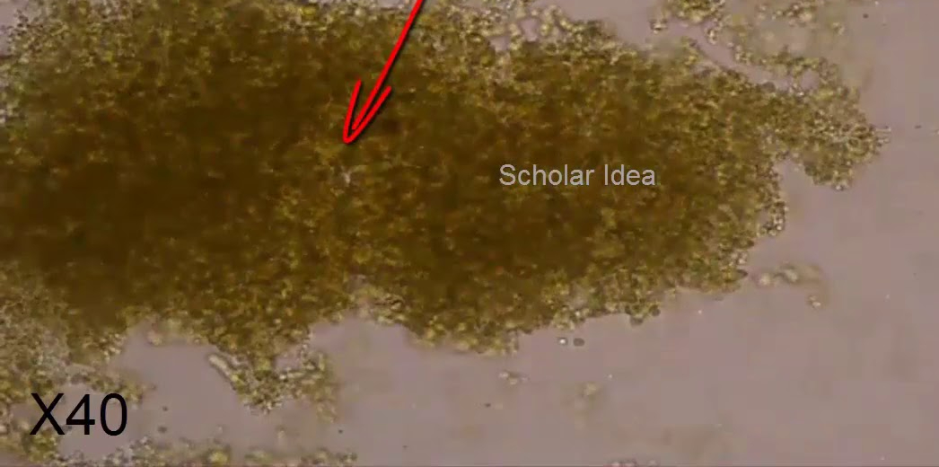 <p>alkaline urine, what is this?</p>