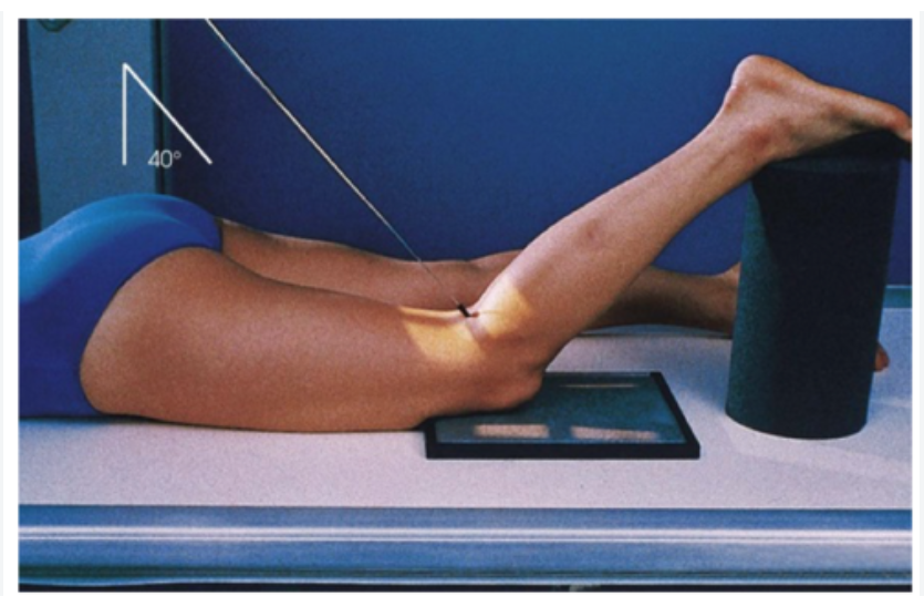 <p>Intercondylar fossa</p><p>Prone position with 40-50 degree flexion and center IR at knee joint</p>