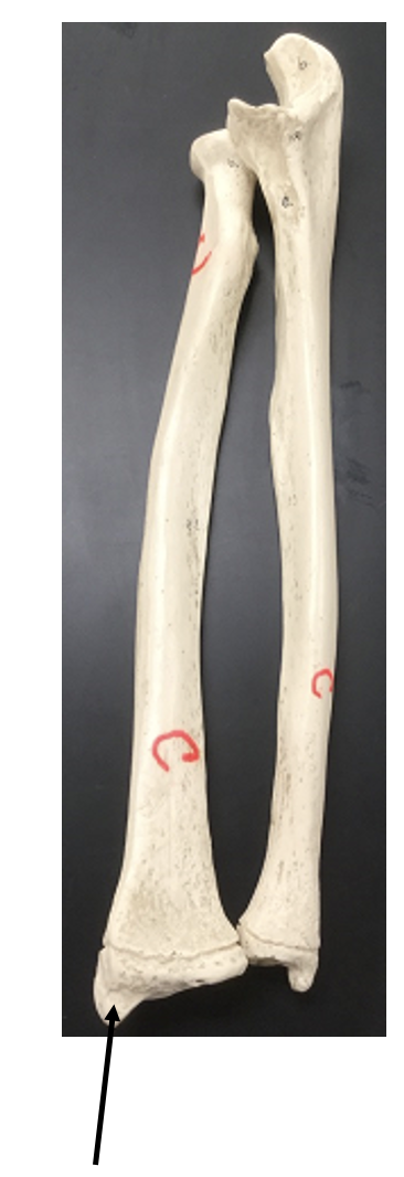 <p>What bone and bone feature is this?</p>