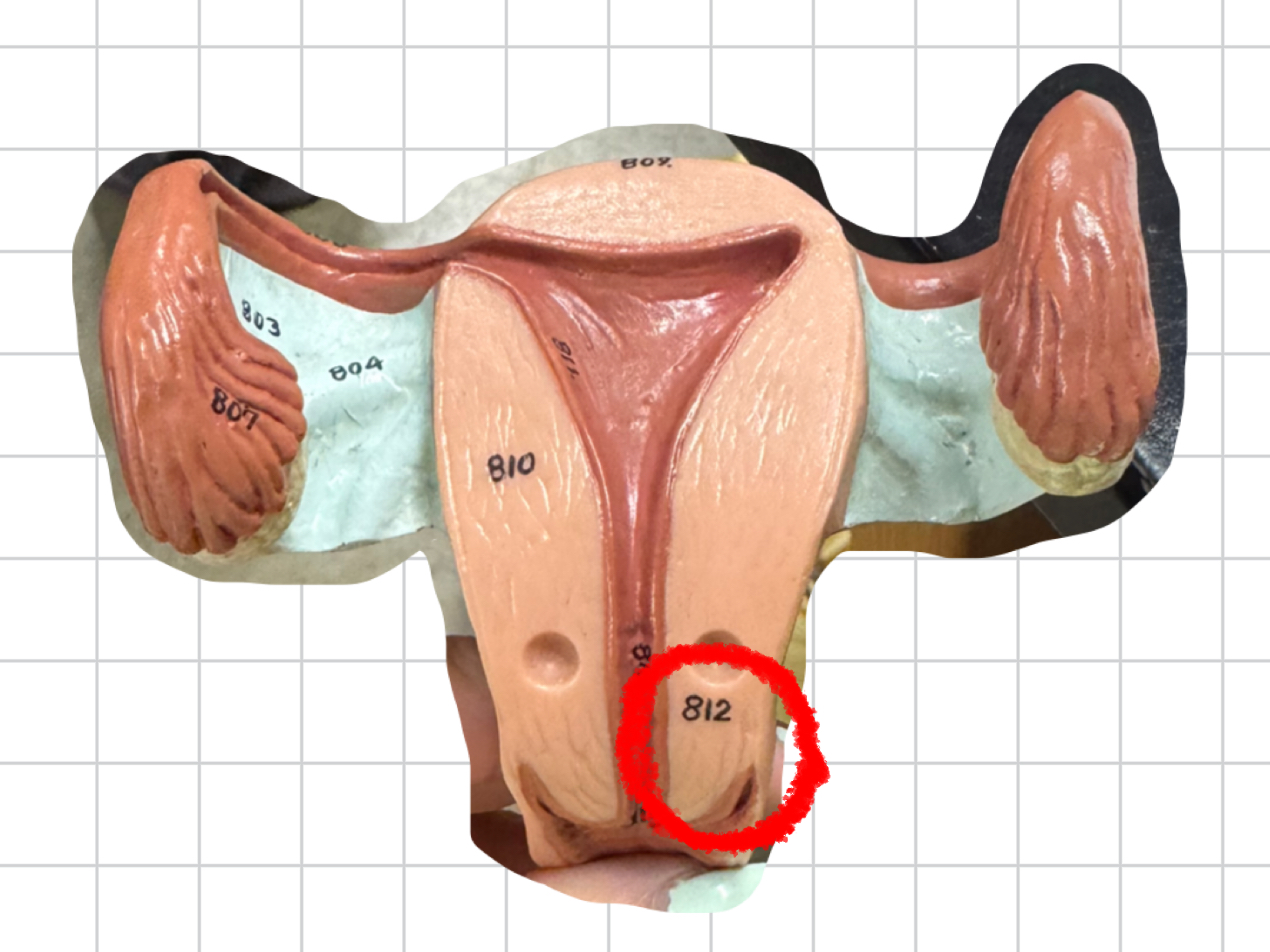 term image