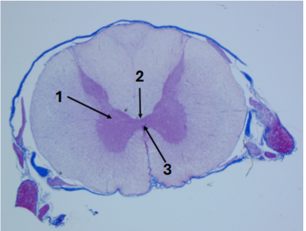 <p>Slide 38</p>