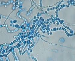 <p>also have teardrop microconidia and rat tailed macroconidia</p>