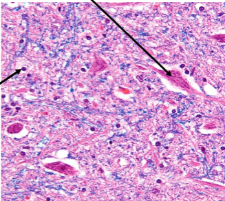 <p>Slide 30</p>