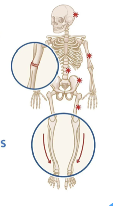 <ul><li><p>Skull</p></li><li><p>vertebrae</p></li><li><p>sacrum</p></li><li><p>sternum</p></li><li><p>pelvis</p></li><li><p>femur.</p></li></ul><p></p>