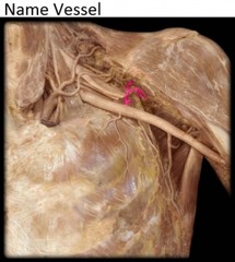 <p>Identify the structure</p>