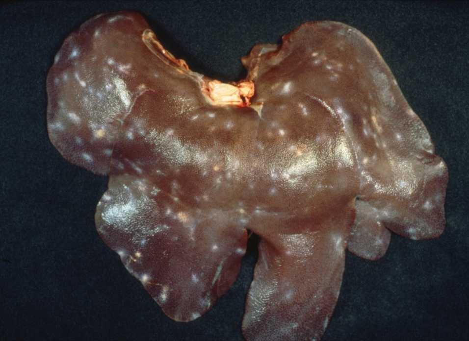 <p>What species cause milk spots on the liver?</p>