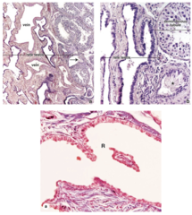 <p>What is the rete testis?</p>