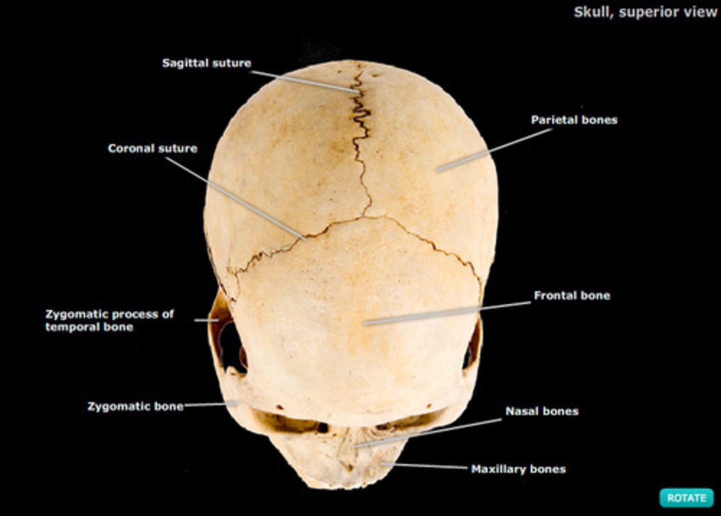 <p>bones united by fibrous tissue or cartilage</p><p>immoveable (sutures in skull) or slightly moveable (vertebrae)</p>