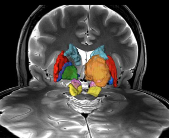 <p>What is the red, green and dark blue section in this image</p>