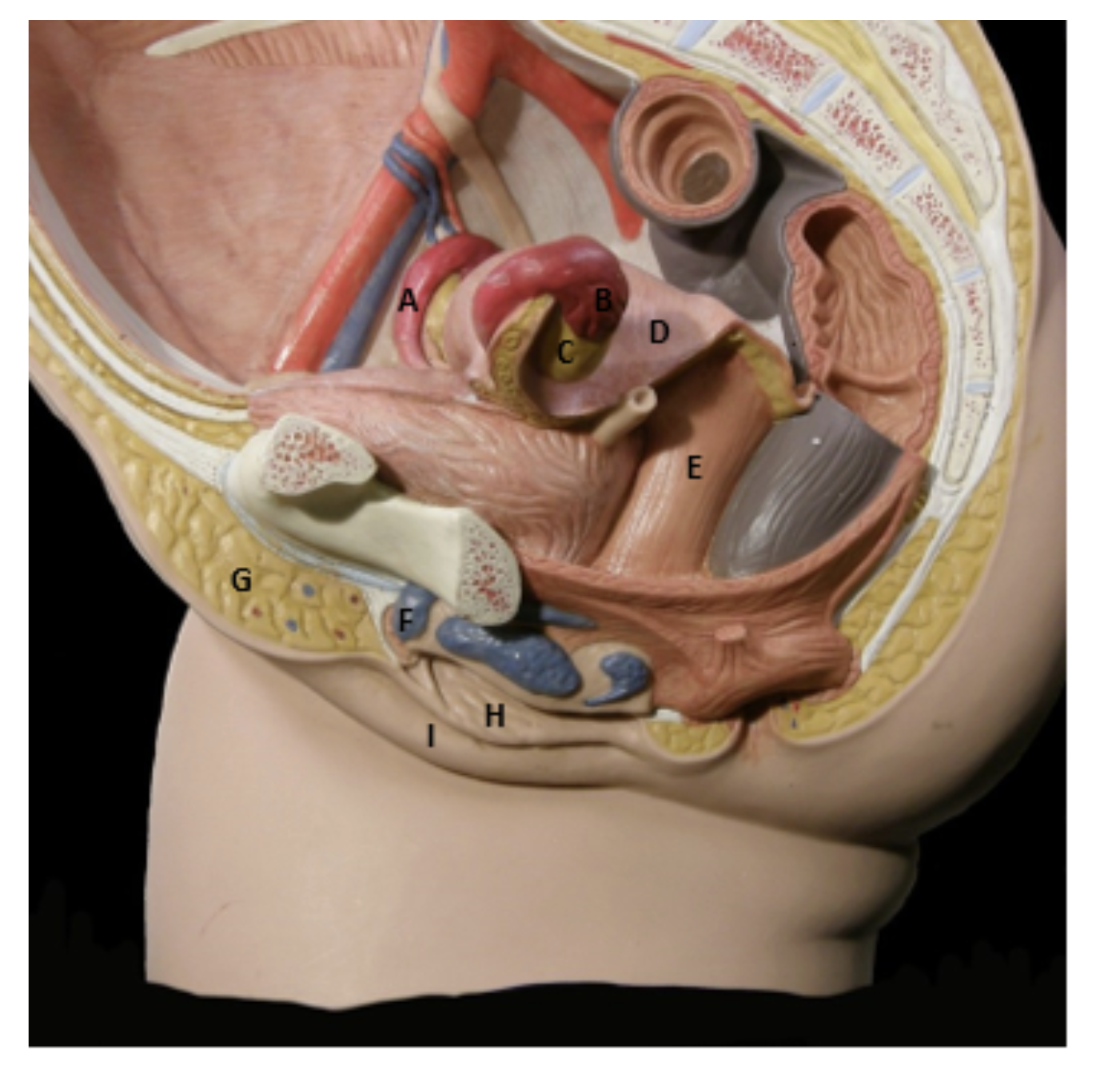 <p><span>Identify the indicated structures of the female reproductive system</span></p>