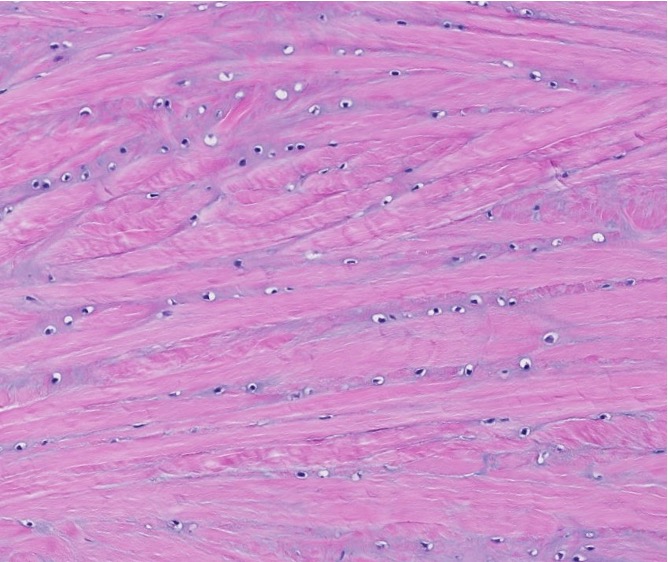 <p><span style="font-family: "Calibri Light";">Which type of CT is this?</span></p>