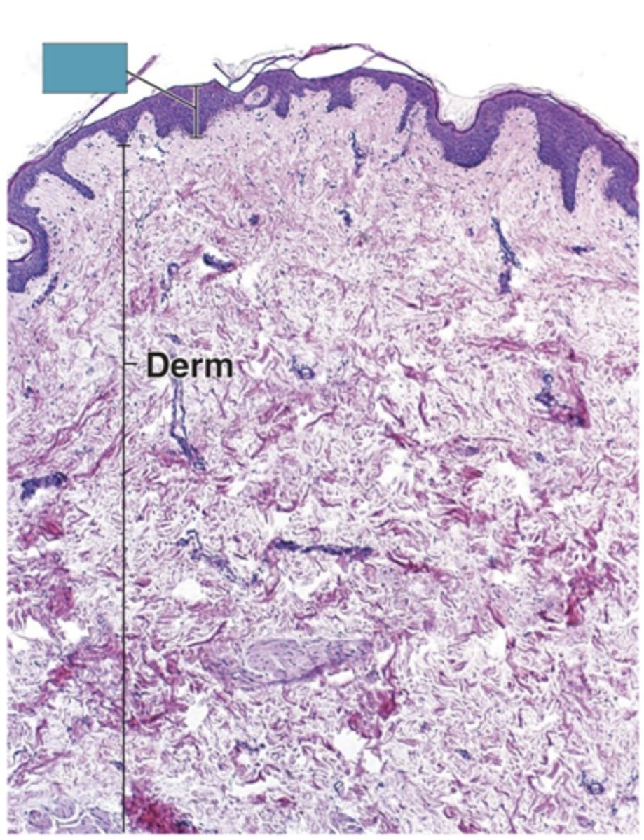 <p>Identify the layer of the skin</p>