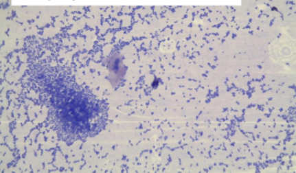 <p>Bacteria species:</p><p>Acid-fast + / - : </p><p></p>