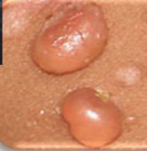 <p>bulla</p>