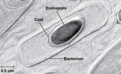 <p>Endospores</p>