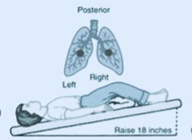 <p>What position is this?</p>