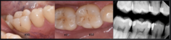 <p>What is the classification for #31?</p>