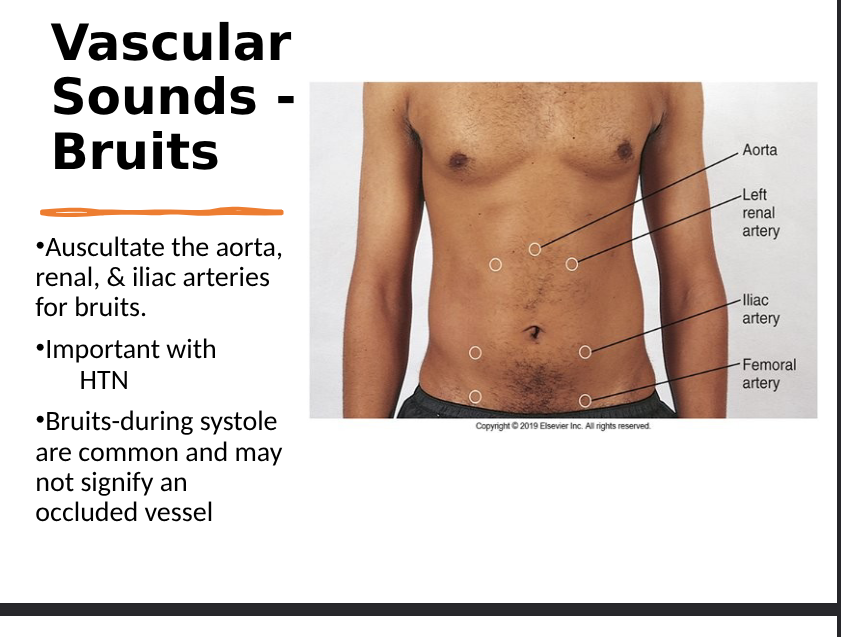 <p>bruit- swishing sounds (turbulent blood flow), constriction of vessel, in hepatic area can indicate liver cancer or hepatitis, during systole are common and may not signify an occluded vessel</p>