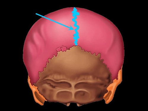 term image