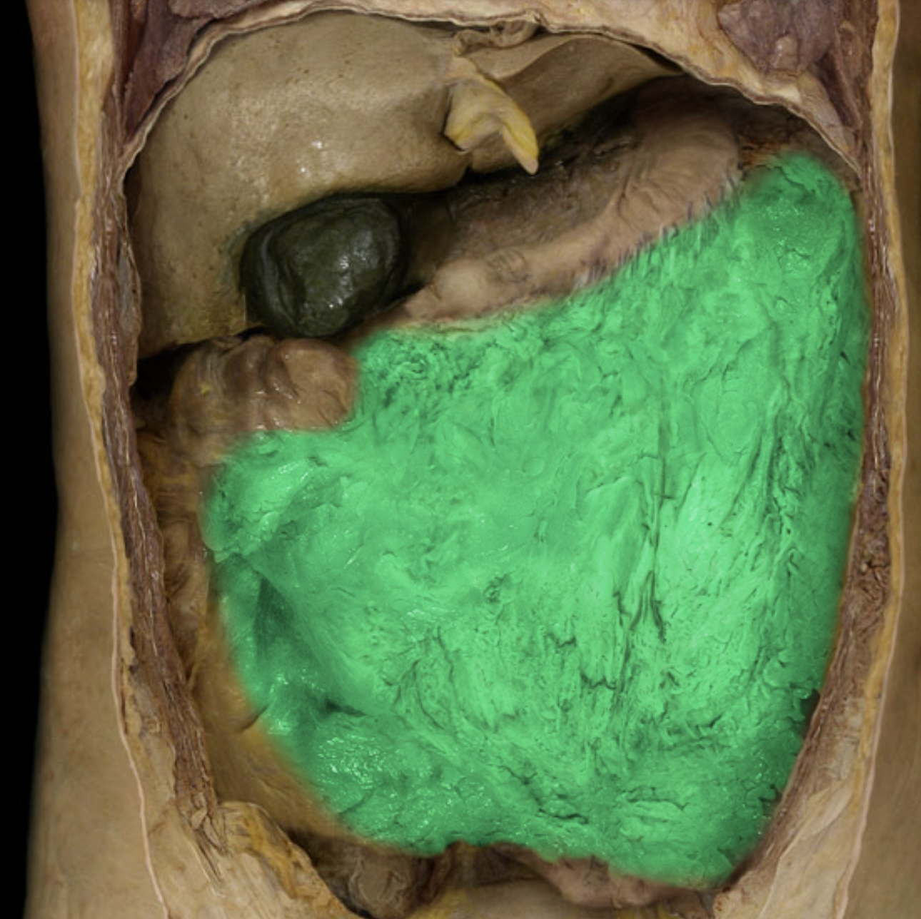 term image