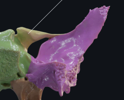 <p>What is this pointing to? What bone is it on?</p>