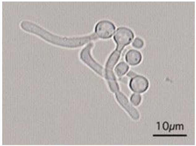 <p>What is the structure seen and what is the genus and species</p>