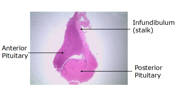 <p>what gland is this? </p>