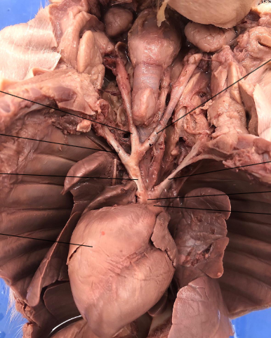 <p>Where is the pulmonary artery and what does it do?</p>