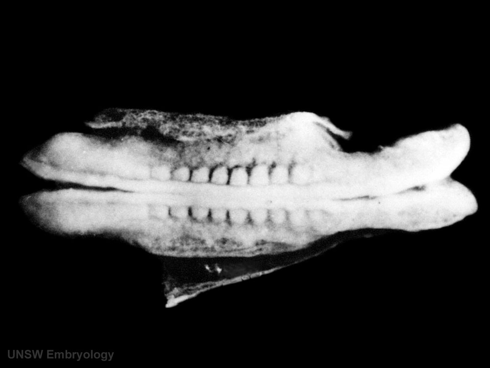 <p>Label the following:</p><ul><li><p>yolk sac</p></li><li><p>somites</p></li><li><p>caudal neuropore</p></li><li><p>cranial neuropore</p></li><li><p>fusing neural folds</p></li><li><p>heart</p></li></ul><p></p>