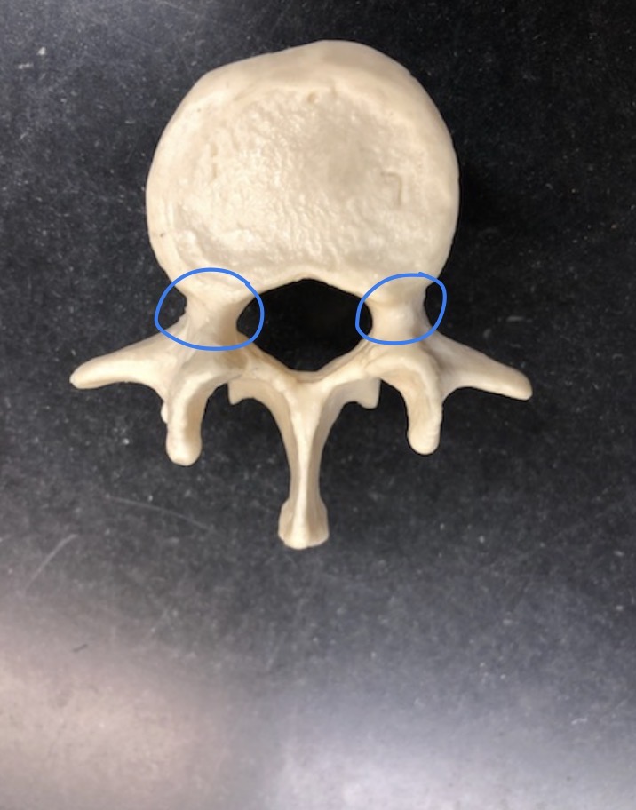 <p>what is this STRUCTURE?</p>