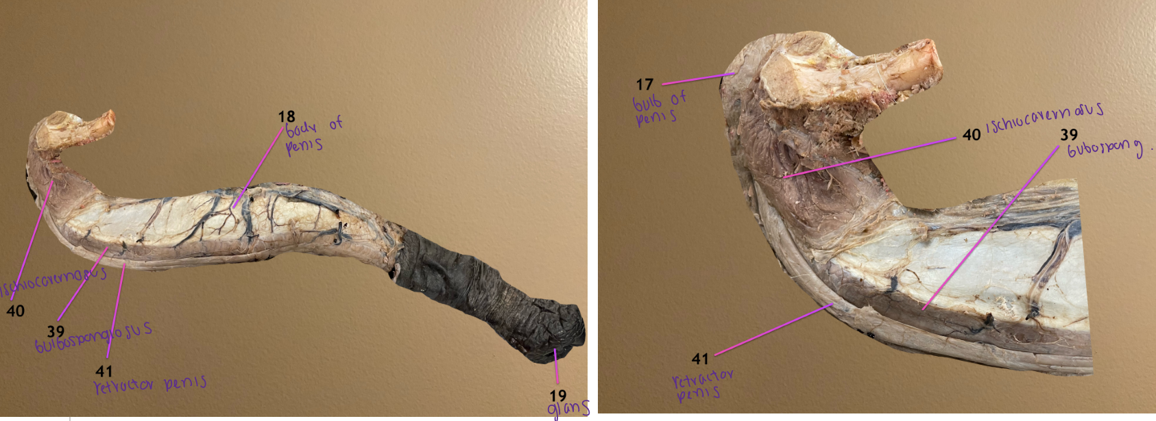 <ol start="17"><li><p>bulb of penis: sits between the crura &amp; serves as beginning of corpus spongiosum penis </p></li><li><p>body of penis</p></li><li><p>glans penis</p></li></ol><p></p>