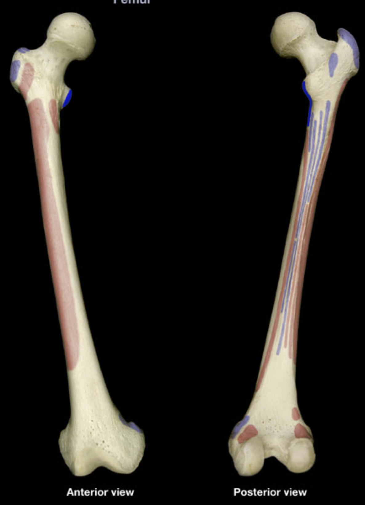 <p>lesser trochanter of femur</p>