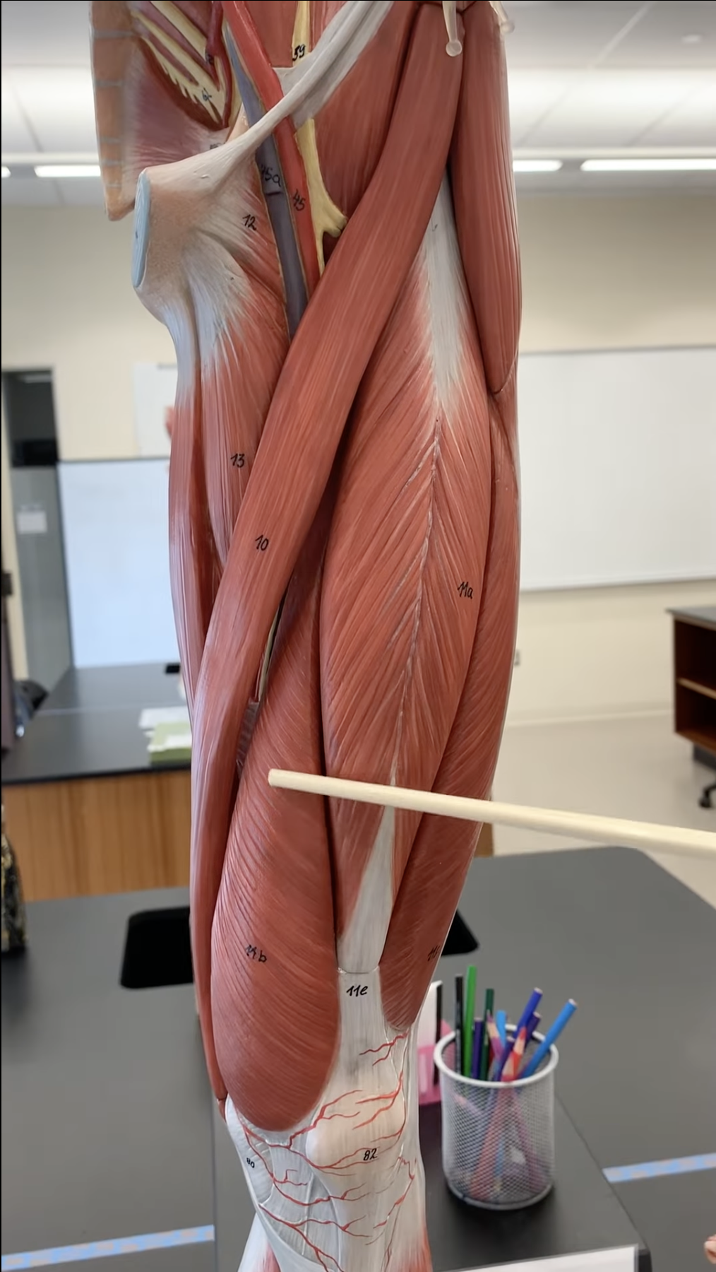 <p>Vastus Medialis</p>