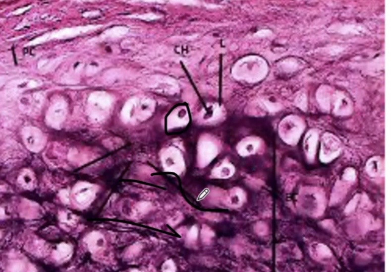 <p>Example of elastic cartilage </p>