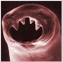 <p>- Commonest worm infections</p><p>- 3.5 Billion people infected (50% of worlds pop)</p><p>- 450 million seriously ill (mainly children)</p><p>- 125,000 deaths per year, 39 million DALYs (basically total number of years of life lost)</p><p>- Situation unchanged for 50 years</p><p>- No intermediate host, not zoonotic</p><p>- Eggs or larvae infect humans</p><p>- Ingested or larvae burrow into skin</p>