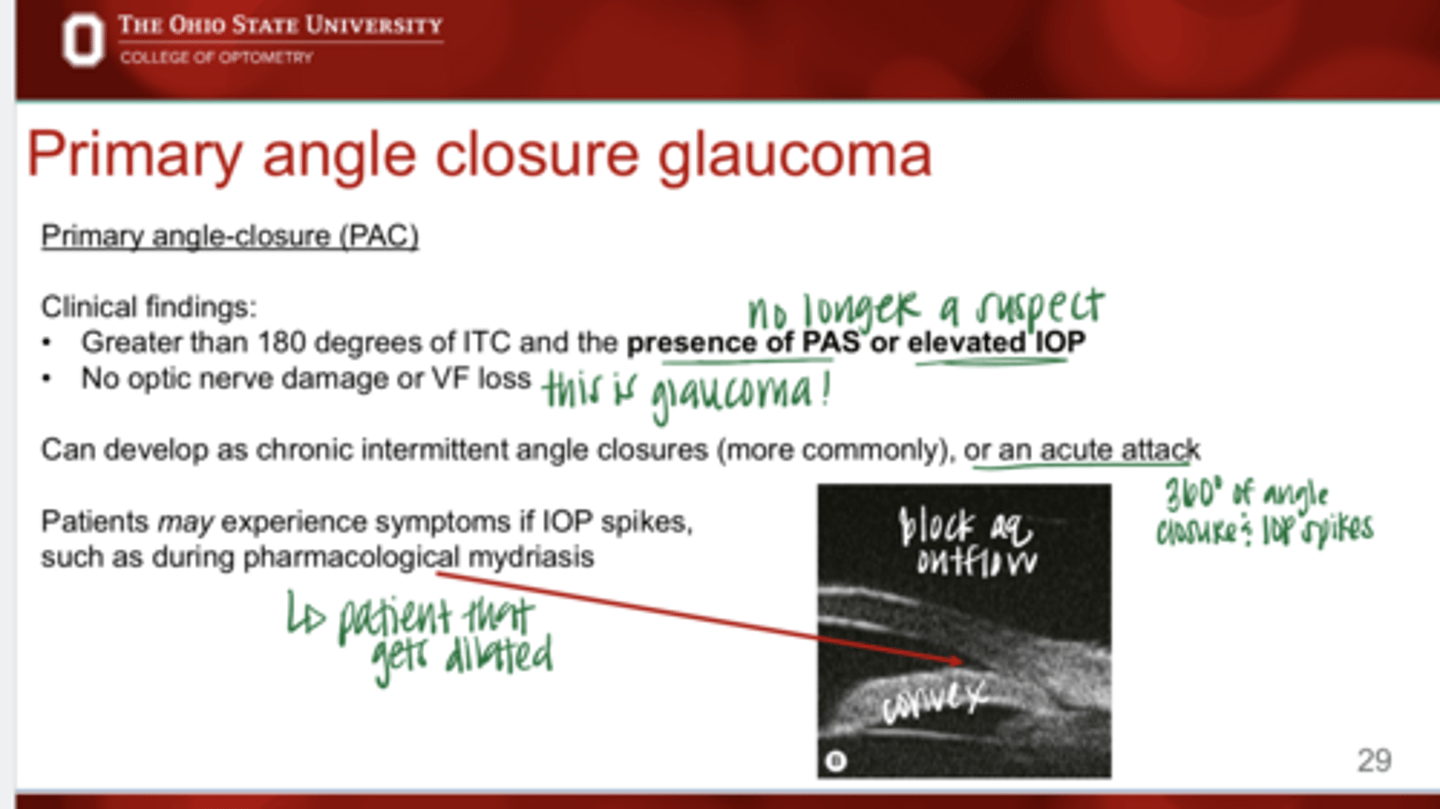 <p>Which is more common?</p><p>chronic intermittent angle closure or as acute attacks</p>