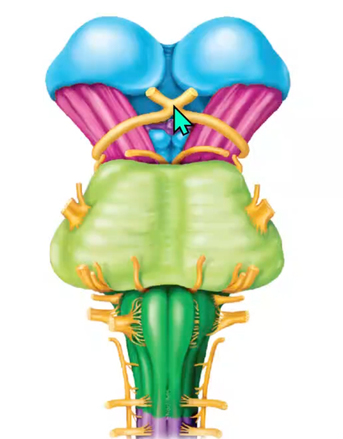 term image