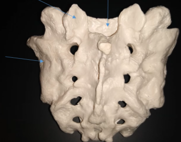 <p>What is the left side of the sacrum?</p>