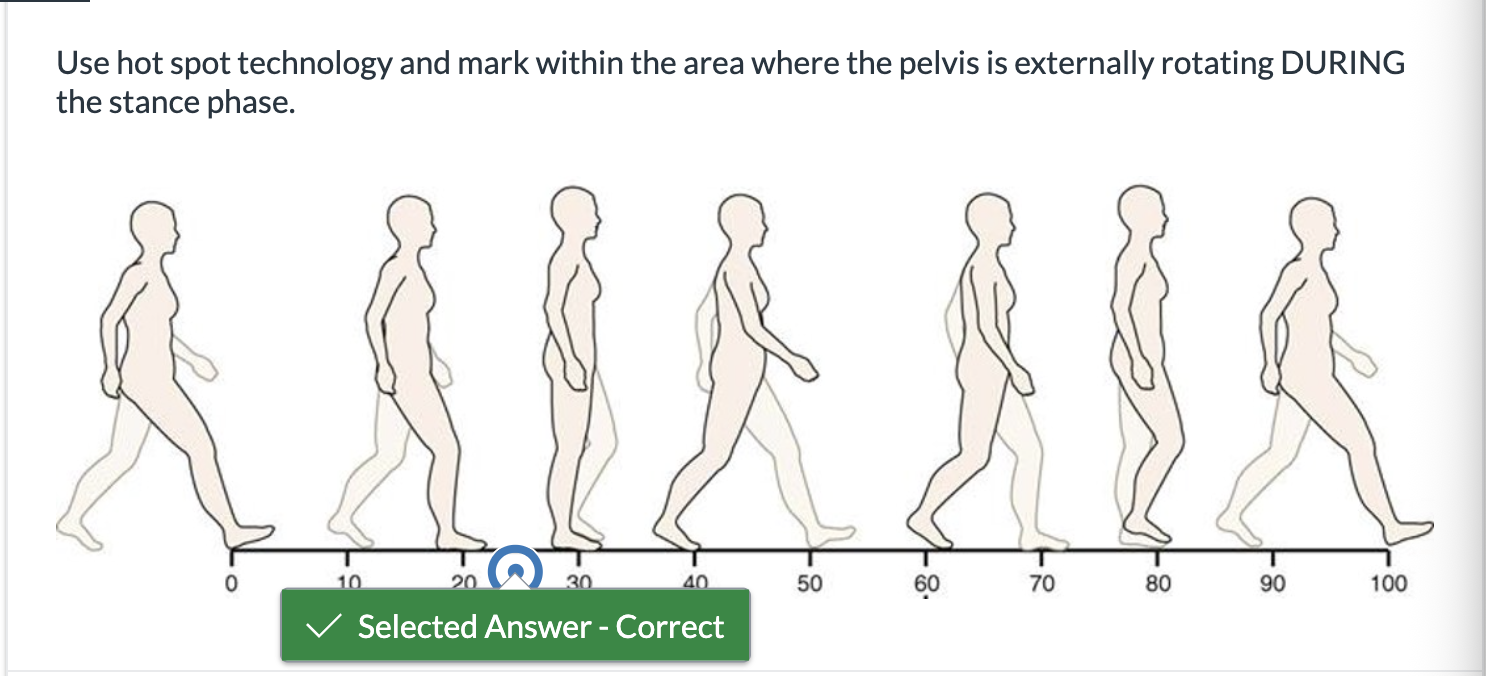 <p><span>Use hot spot technology and mark within the area where the pelvis is externally rotating DURING the stance phase.</span></p>