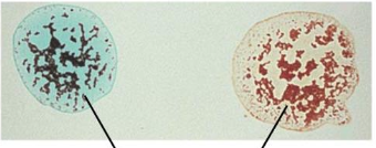 <p>What blood type is this?</p>