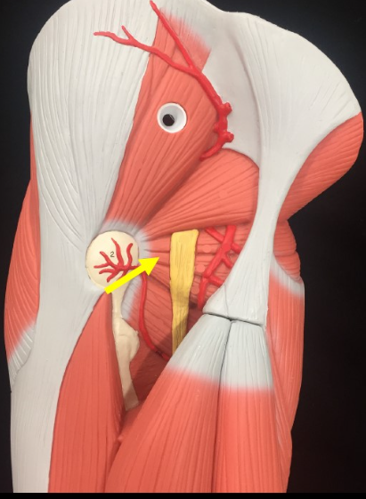 <p>Name the muscle</p>