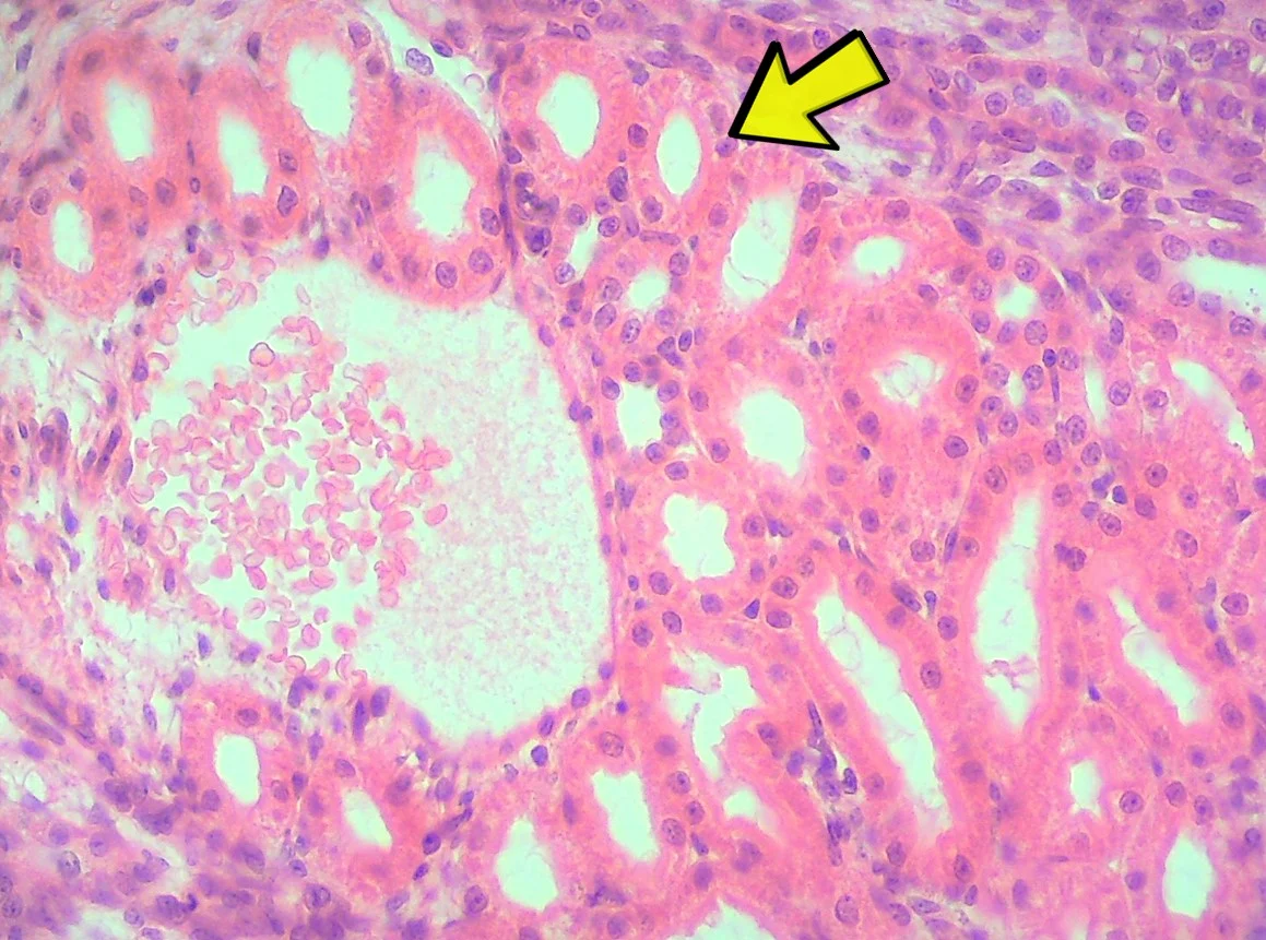 <p><span>Identify the tissue type in the micrograph at the yellow arrow.</span></p>