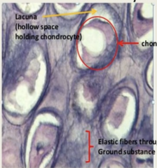 <p>Identify the type of cartilage?</p>