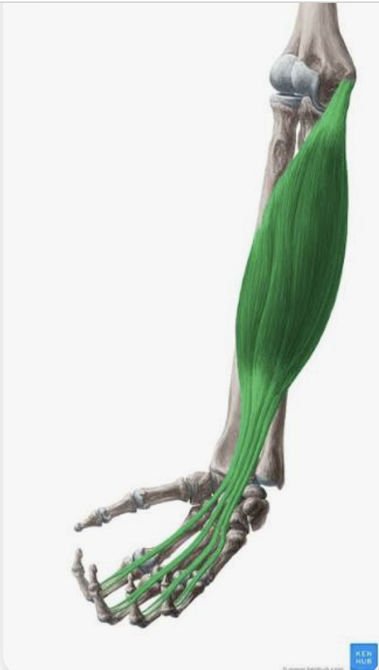 <p>O: Medial epicondyle of humerus, coronoid process of ulna, upper surface of radius</p><p>I: Middle phalanges of digits 2-5</p><p>A: Flexion of proximal and middle phalanges of digits 2-5, flexion of hand, weak flexion of forearm</p><p>N: Median nerve</p>