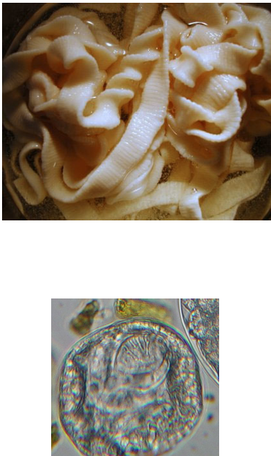 <p>Ribbon-like tapeworms in small intestine </p><p>2 species in cattle, sheep, goats, ruminants</p>