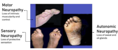 <p>List the 3 types of diabetic neuropathy.</p>